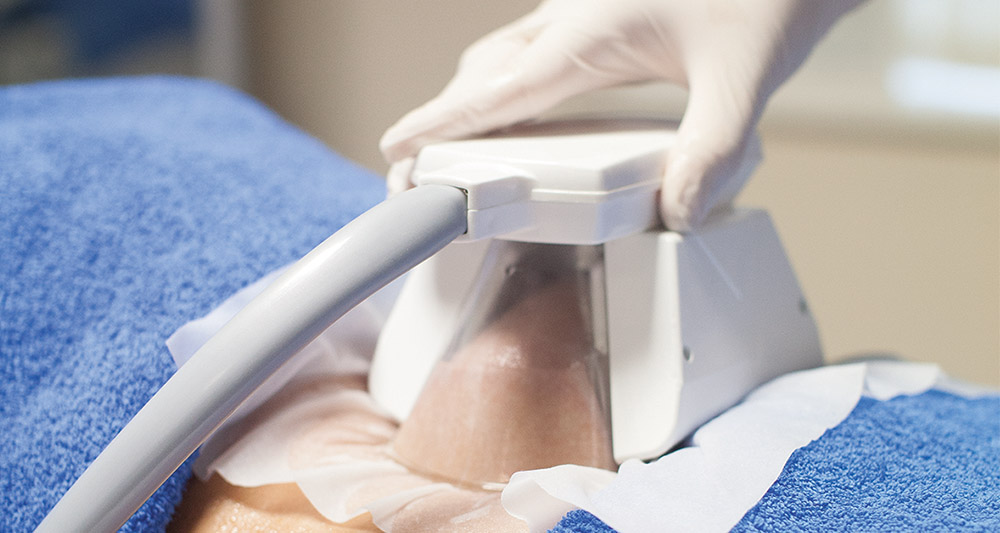 How Fat Freezing and HIFU Work Together? 2 Multiple Areas in One Session HIFU and Fat Freezing Walton-on-Thames
