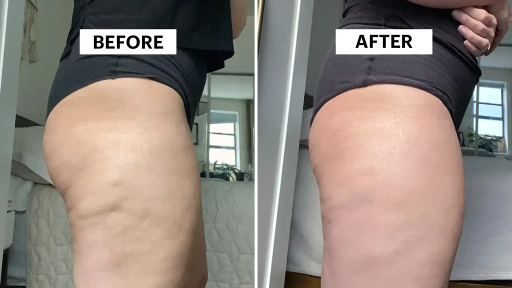 Do Toning Exercise Walton-on-Thames Really Tackle Cellulite?