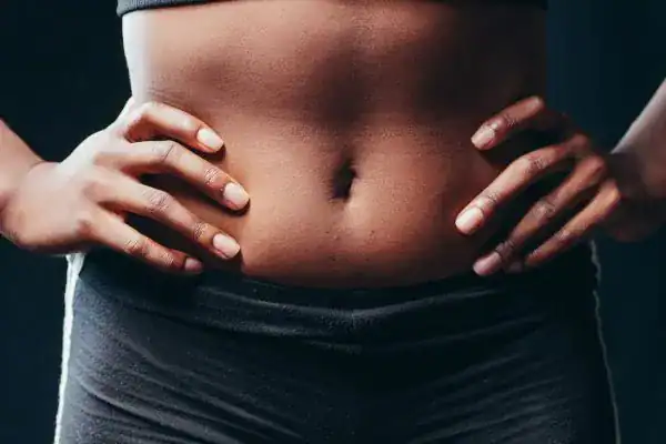 Image of a toned stomach after non surgical treatment Walton-on-Thames